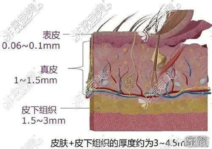 案例图片