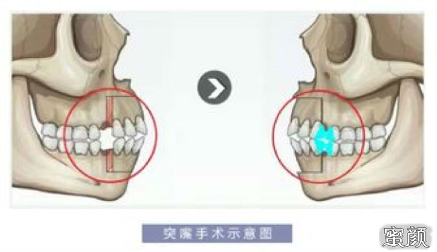 案例图片