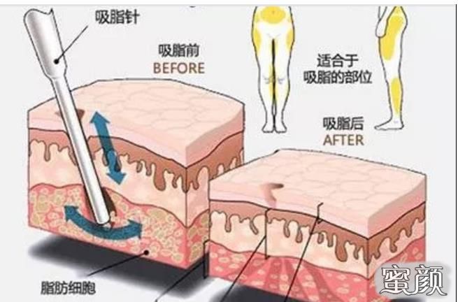案例图片