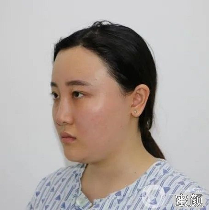 案例图片