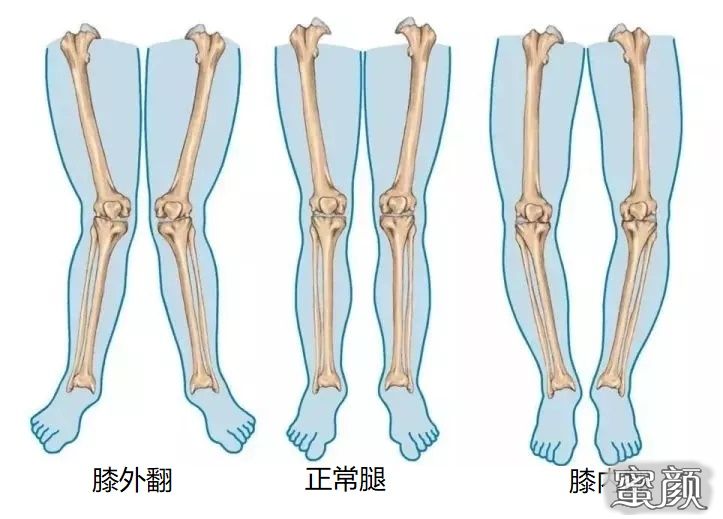 案例图片