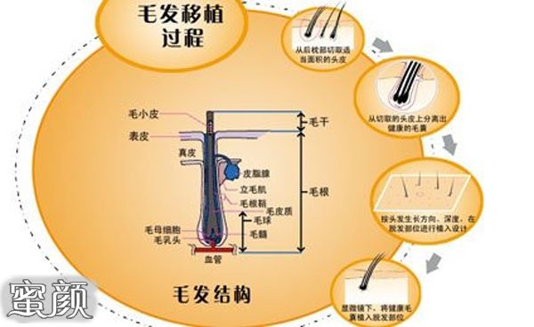 案例图片