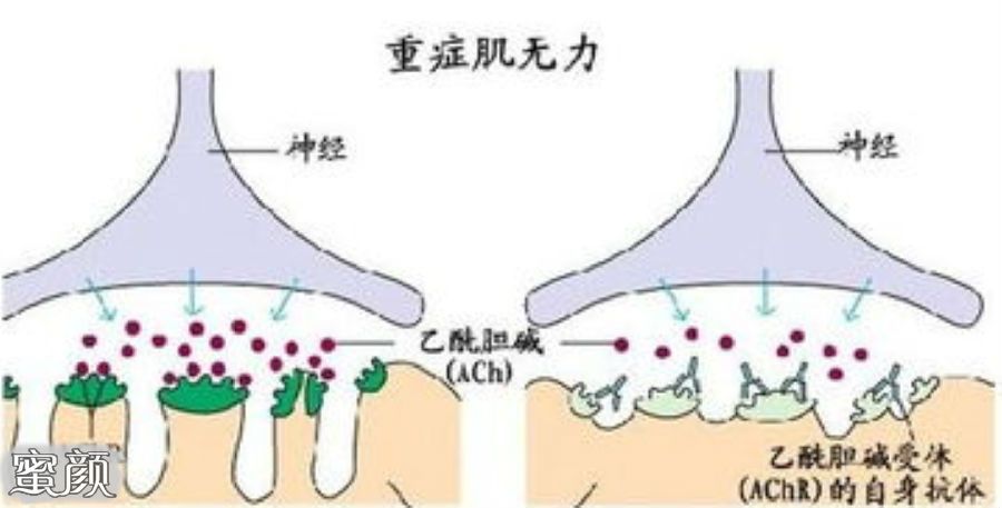 案例图片