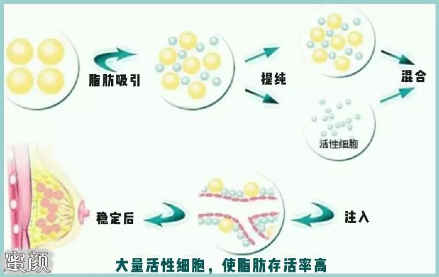 案例图片