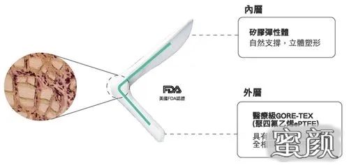 案例图片