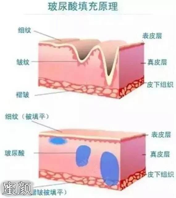 案例图片