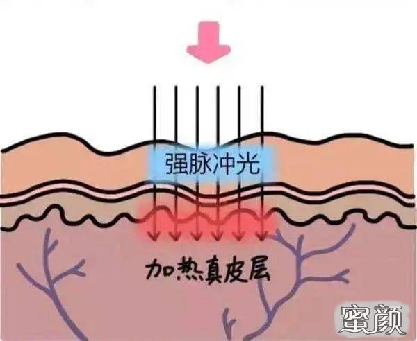 案例图片