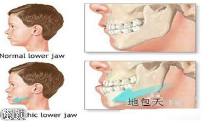 案例图片