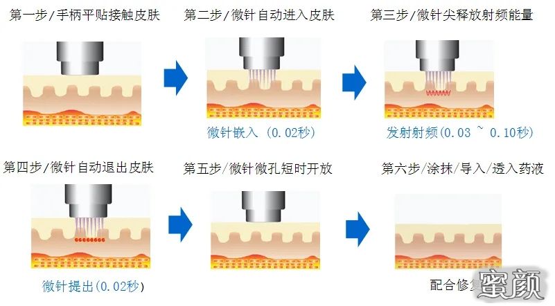 案例图片