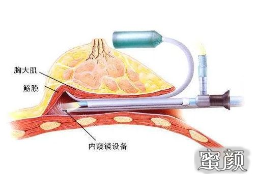 案例图片