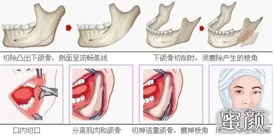 案例图片