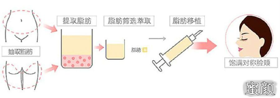 案例图片