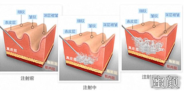 案例图片