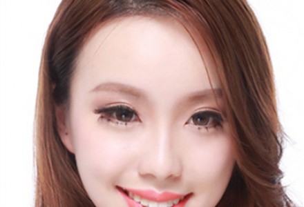 天津切眉-