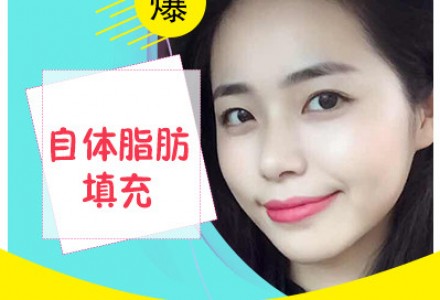 佛山自体脂肪面部填充-
