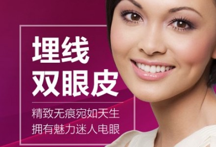 广州埋线双眼皮-