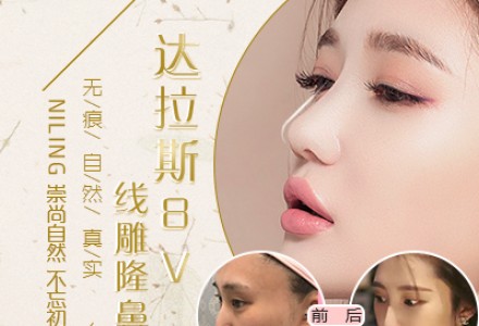 武汉线雕隆鼻-