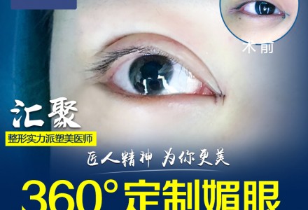 广东晨曦眼综合-