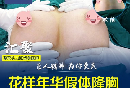 广州晨曦假体隆胸-