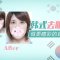 眼睛臃肿无神 眼袋显老 内切法帮你轻松改善 更显活力