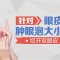 切开双眼皮 妩媚大眼靓出来