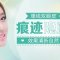 效果自然清新不显假 赶紧丢掉双眼皮贴