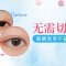 告别单眼皮 埋线塑造明亮大眼