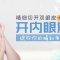 靓出你的睛彩  双眼神采奕奕