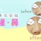 玻尿酸隆出挺翘美鼻 立体五官塑造精致脸型
