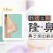 进口韩式生科硅胶隆鼻  给你高挺鼻梁