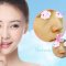 私人订制膨体隆鼻 给你高挺自信美鼻