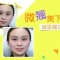 玻尿酸丰下巴 重塑脸部曲线 还你美丽俏下巴