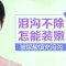 非手术填平泪沟 眼眸不再老气憔悴