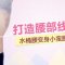 吸脂瘦腰 4折优惠 吸出水蛇腰