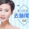 肉毒素除去鱼尾纹让你微笑无忧 微创愈后无痕