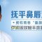 韩国伊婉玻尿酸  留韩整形医生  消除深八字