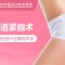 阴道紧缩术 告别松弛干涩漏风声音