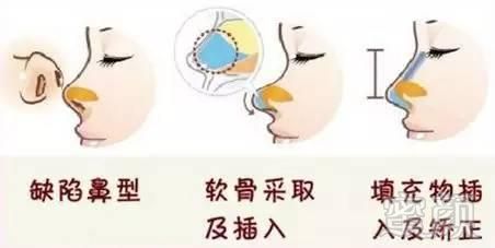 案例图片