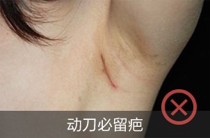 案例图片