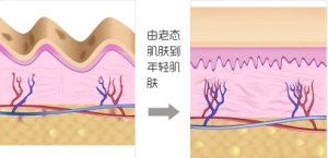 https://img.yiyiaimei.com/mnt/timg/170720/1530164943-3.jpg