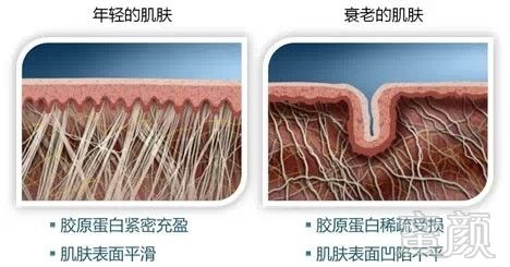 https://img.yiyiaimei.com/mnt/timg/170720/16254921J-0.jpg