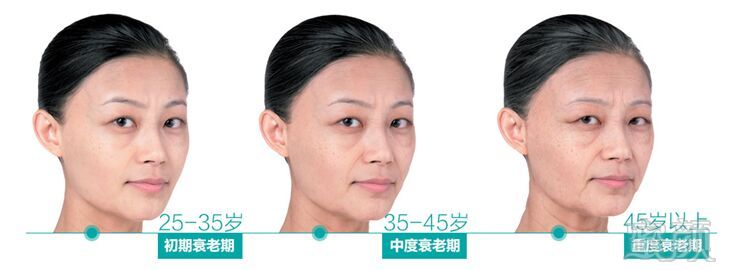 https://img.yiyiaimei.com/mnt/timg/170720/1625503537-1.jpg