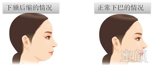 https://img.yiyiaimei.com/mnt/timg/170720/1HT42043-1.jpg