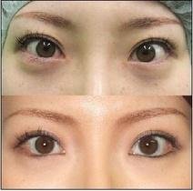 https://img.yiyiaimei.com/mnt/timg/170721/153JU637-0.jpg