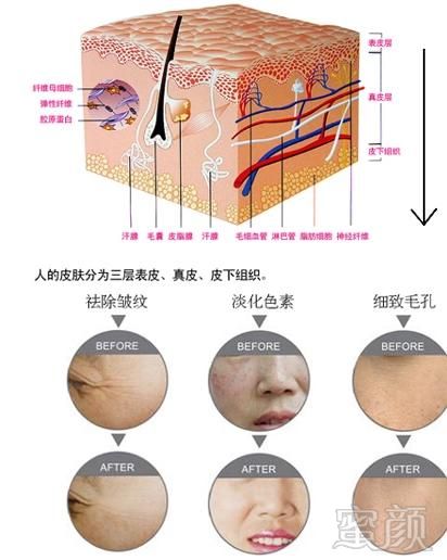 案例图片