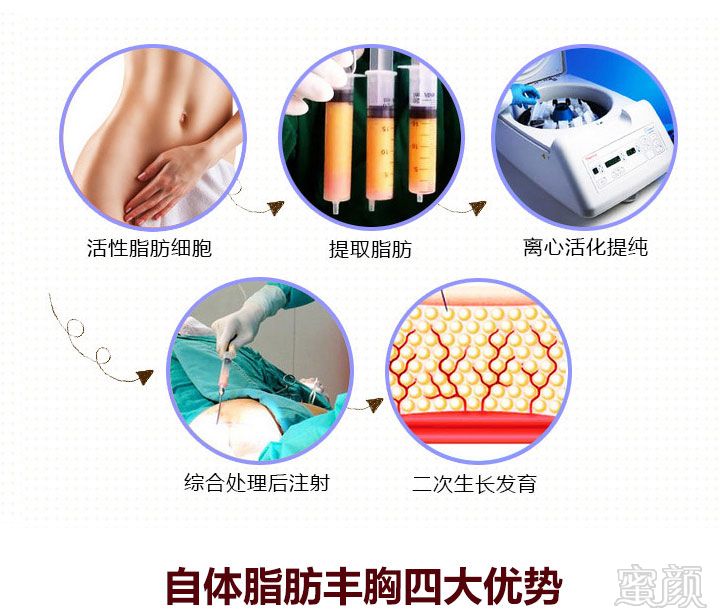 案例图片