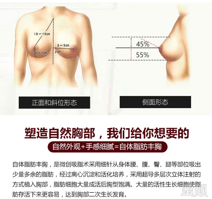 案例图片