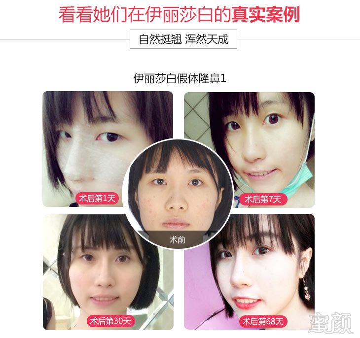 https://img.yiyiaimei.com/mnt/timg/170725/1404062345-1.jpg
