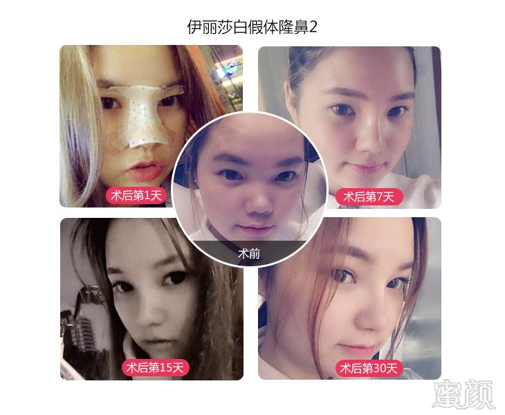 https://img.yiyiaimei.com/mnt/timg/170725/14040HM3-2.jpg