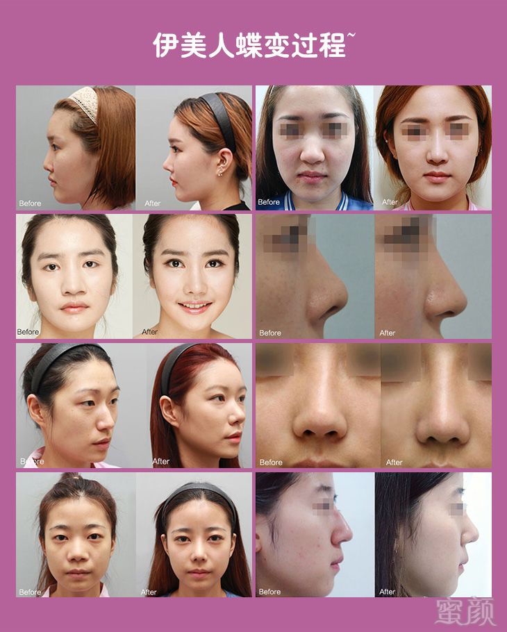 https://img.yiyiaimei.com/mnt/timg/170725/14040S636-4.jpg